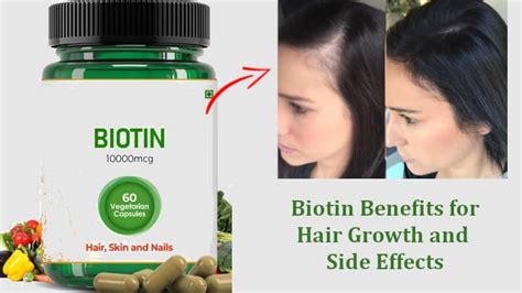 Biotin for hair growth: Dosage and side effects.